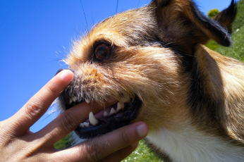 Dog biting a person's hand - Mercer Legal Group services