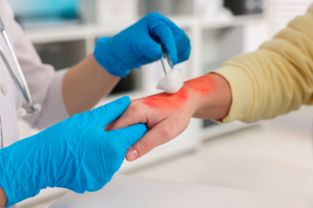 Doctor treating a hand injury - Mercer Legal Group services